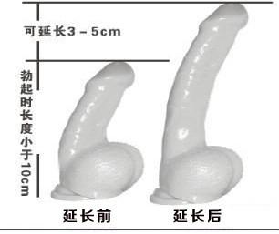 阴经延长